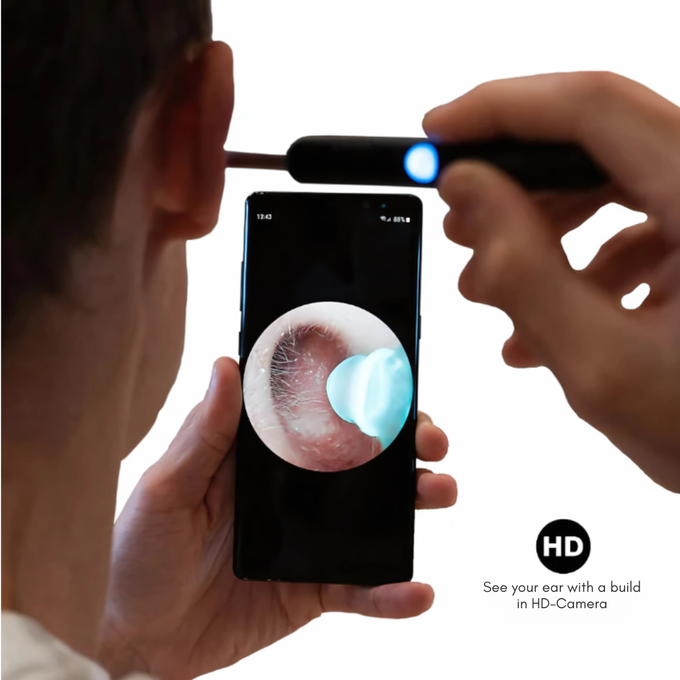 جهاز تنظيف الأذن بكاميرا 1080 بيكسل فائقه الجودة G